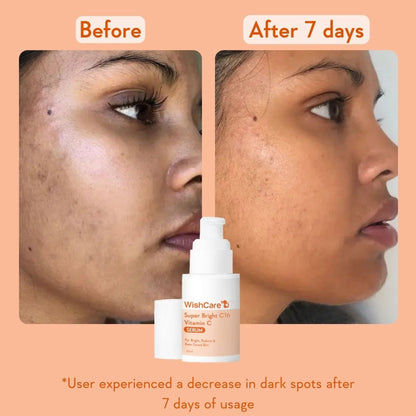 WishCare Super Bright C16 Vitamin C Face Serum for Glowing Skin- Reduces Pigmentation & Dark Spots