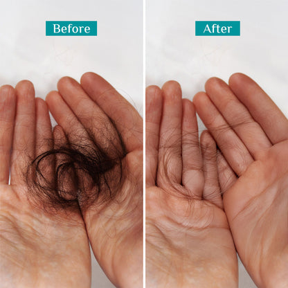 Pilgrim Spanish Rosemary & Biotin Anti Hairfall Control Shampoo Reduce Hairfall Upto 95% Strong Hair
