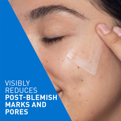 CeraVe Resurfacing Retinol Serum with licorice root extract and niacinamide, reducing acne marks on skin.