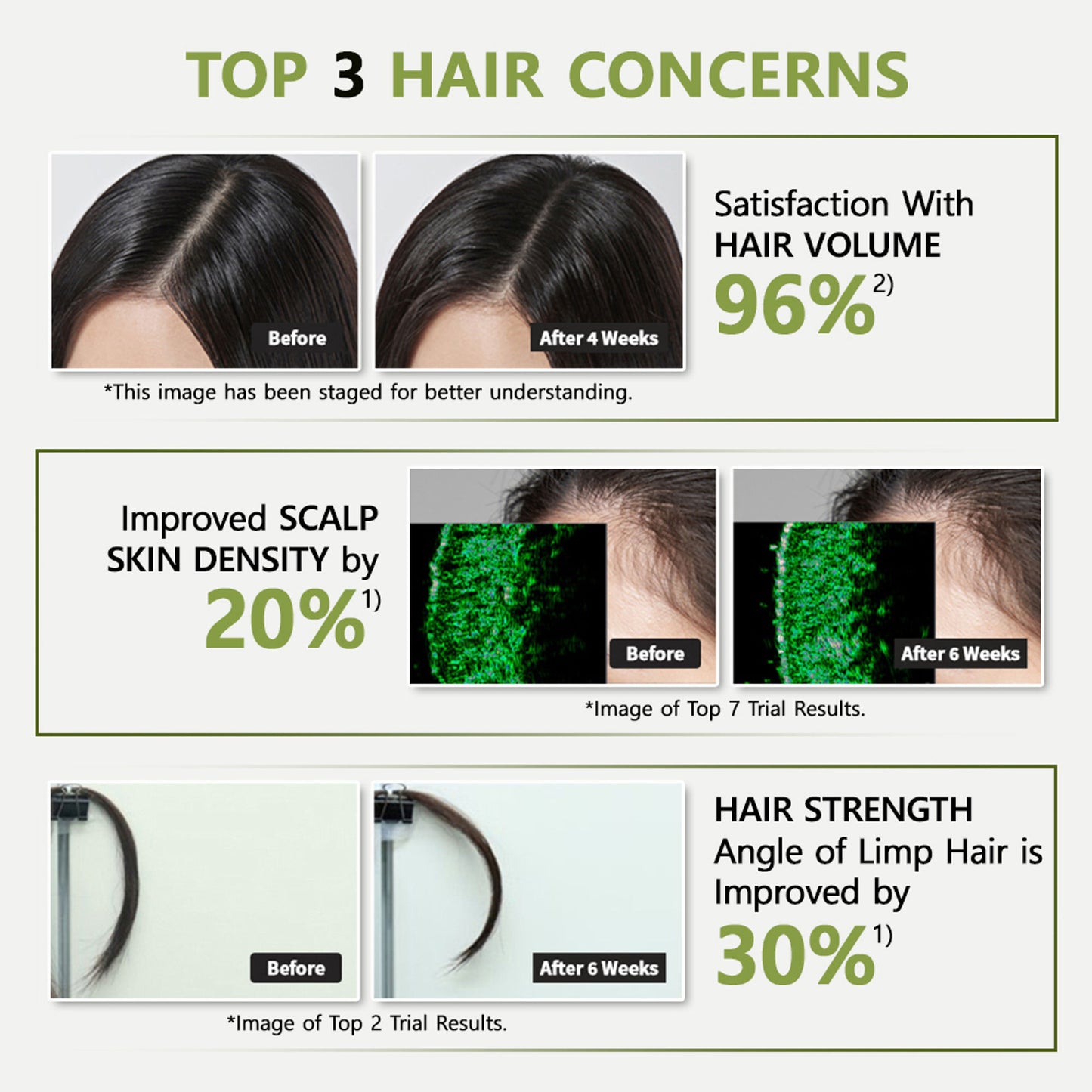 RYO Root: Gen Hair Loss Care Shampoo For Women