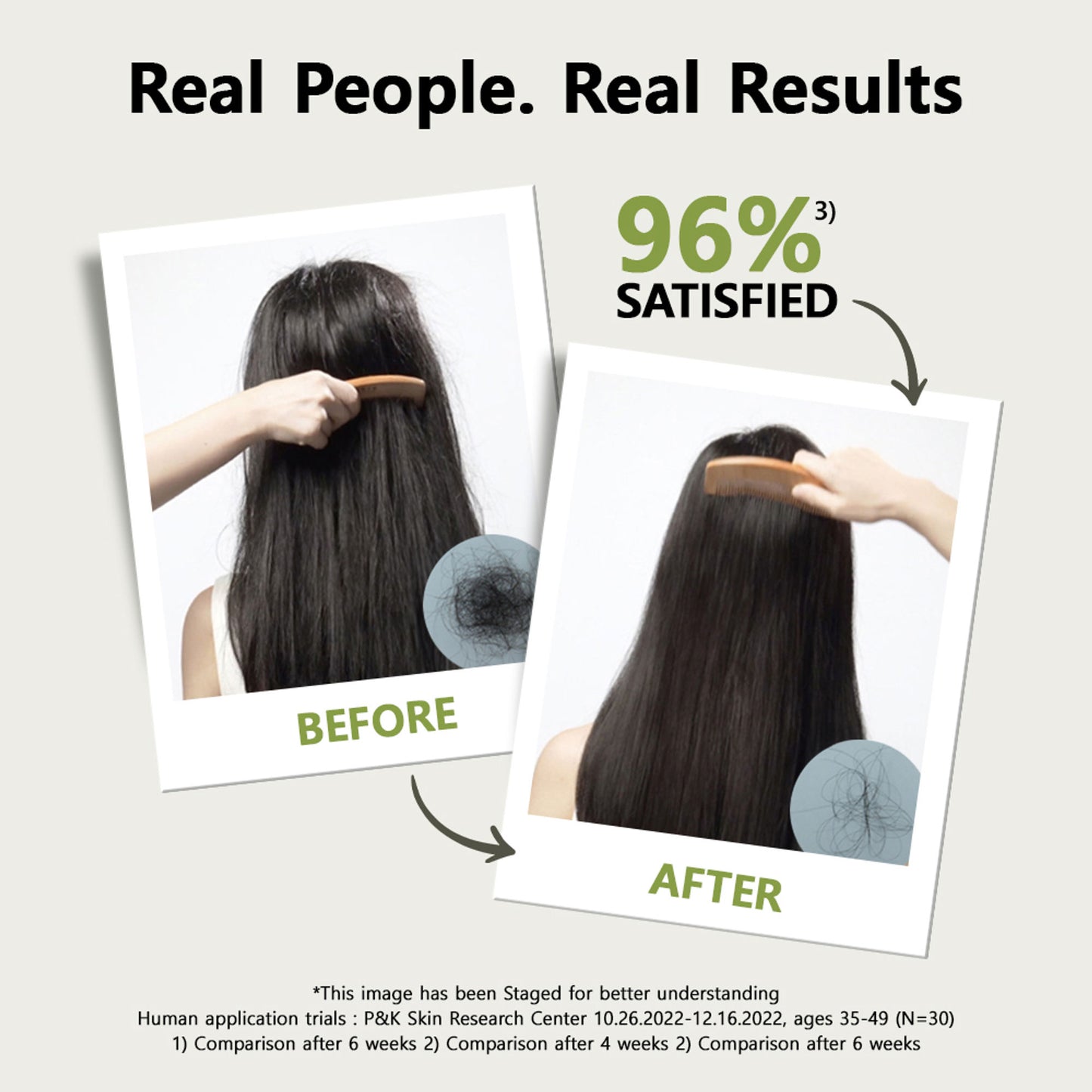 RYO Root: Gen Hair Loss Care Shampoo For Women