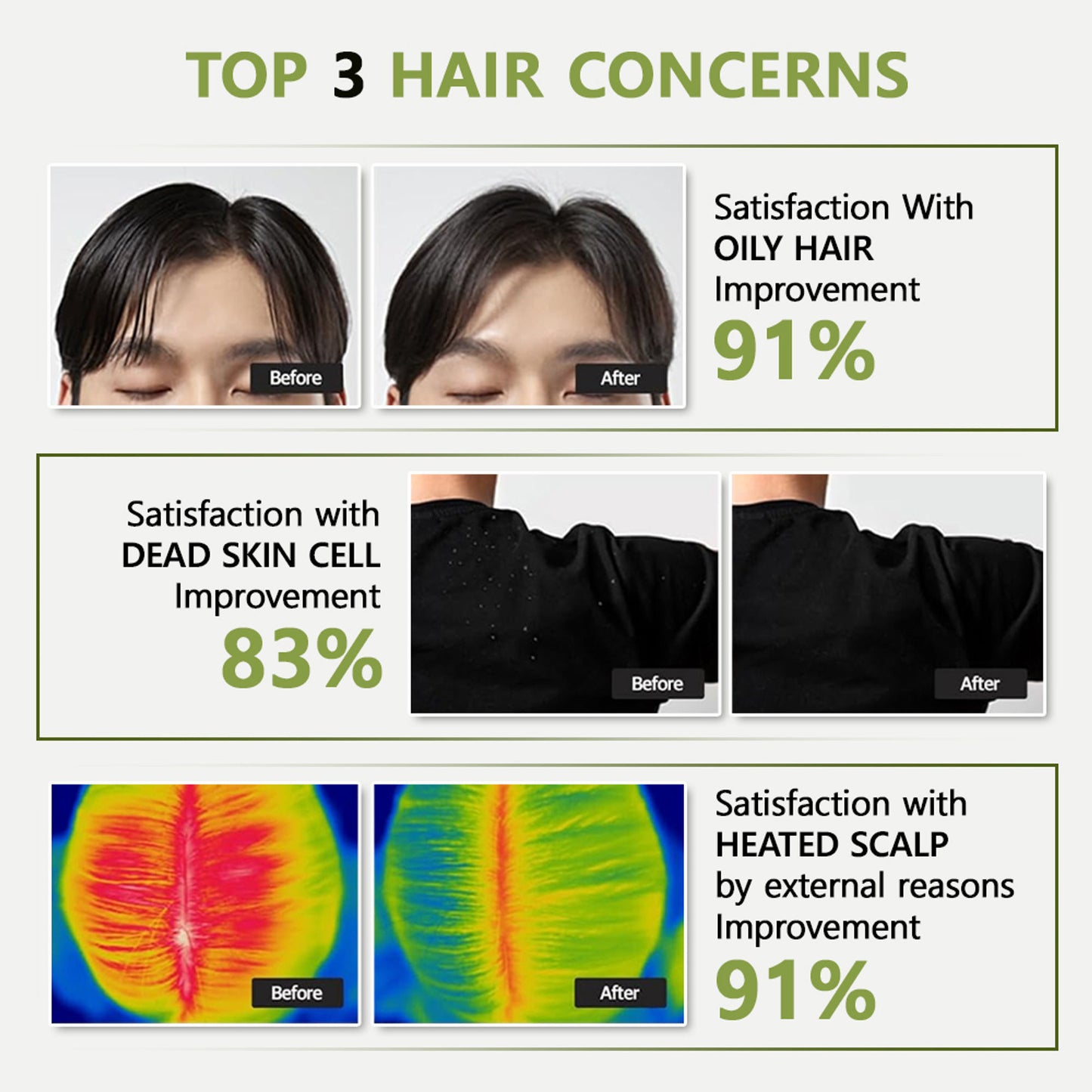 RYO Root: Gen Hair Loss Care Shampoo For Men