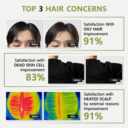 RYO Root: Gen Hair Loss Care Shampoo For Men