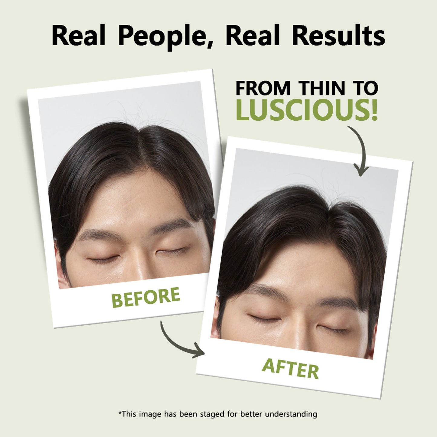 RYO Root: Gen Hair Loss Care Shampoo For Men