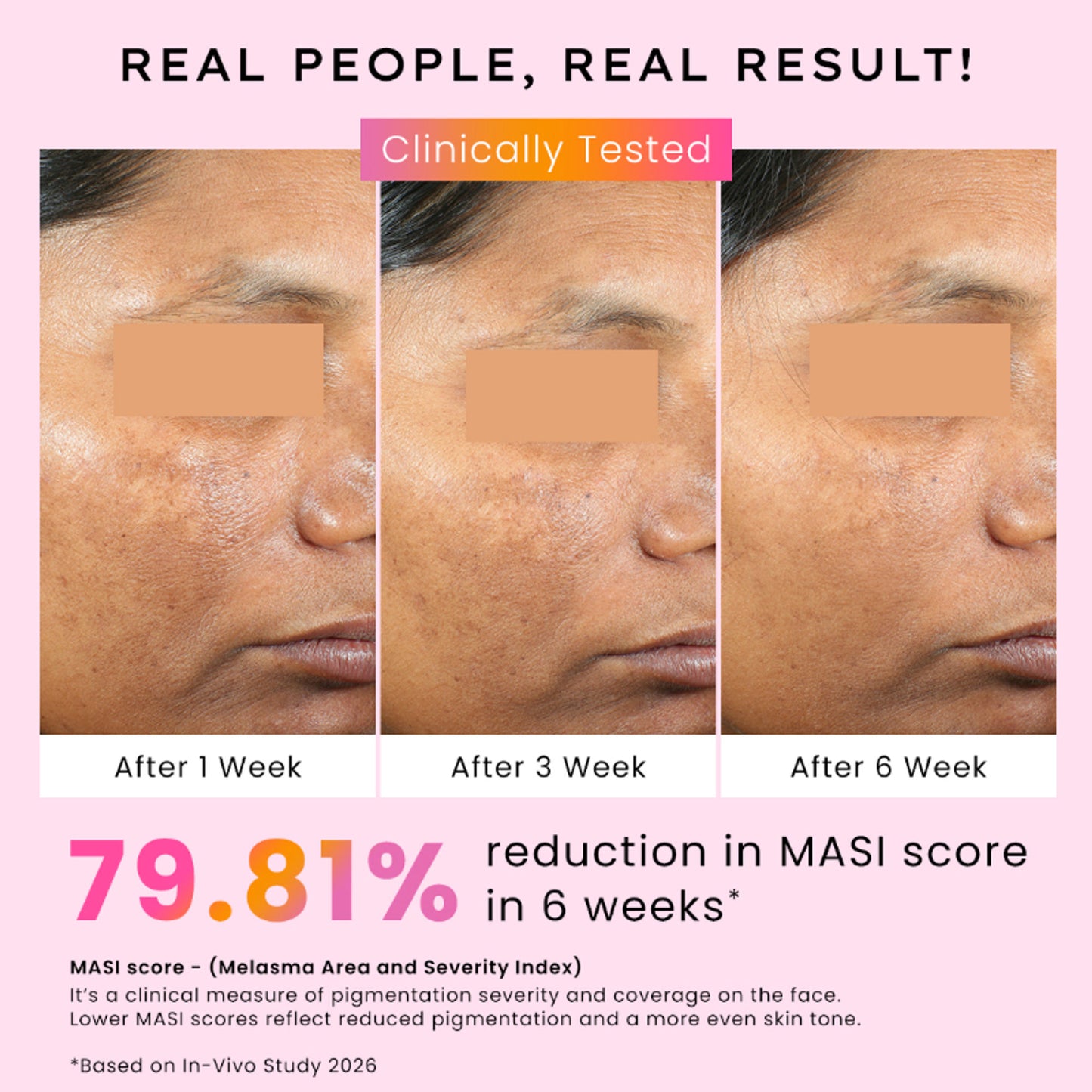 Hyphen Biphasic Advanced De-Pigmentation Serum, Correct & Prevent Pigmentation In-Vivo Tested