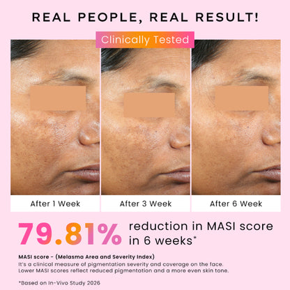 Hyphen Biphasic Advanced De-Pigmentation Serum, Correct & Prevent Pigmentation In-Vivo Tested
