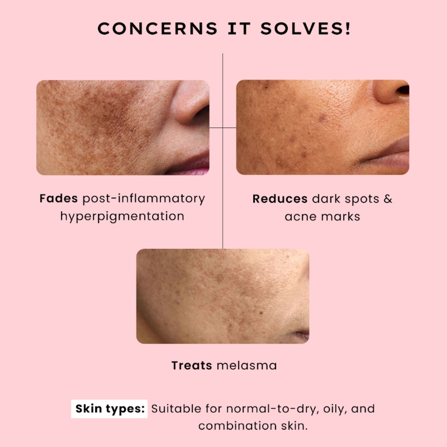 Hyphen Biphasic Advanced De-Pigmentation Serum, Correct & Prevent Pigmentation In-Vivo Tested