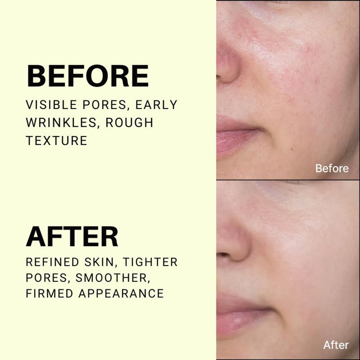 Celimax The Vita-A Retinol Shot Tightening Serum, For Anti-Aging, Dark Spots & Wrinkles