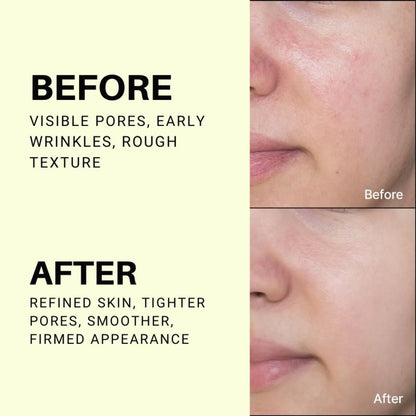Celimax The Vita-A Retinol Shot Tightening Serum, For Anti-Aging, Dark Spots & Wrinkles