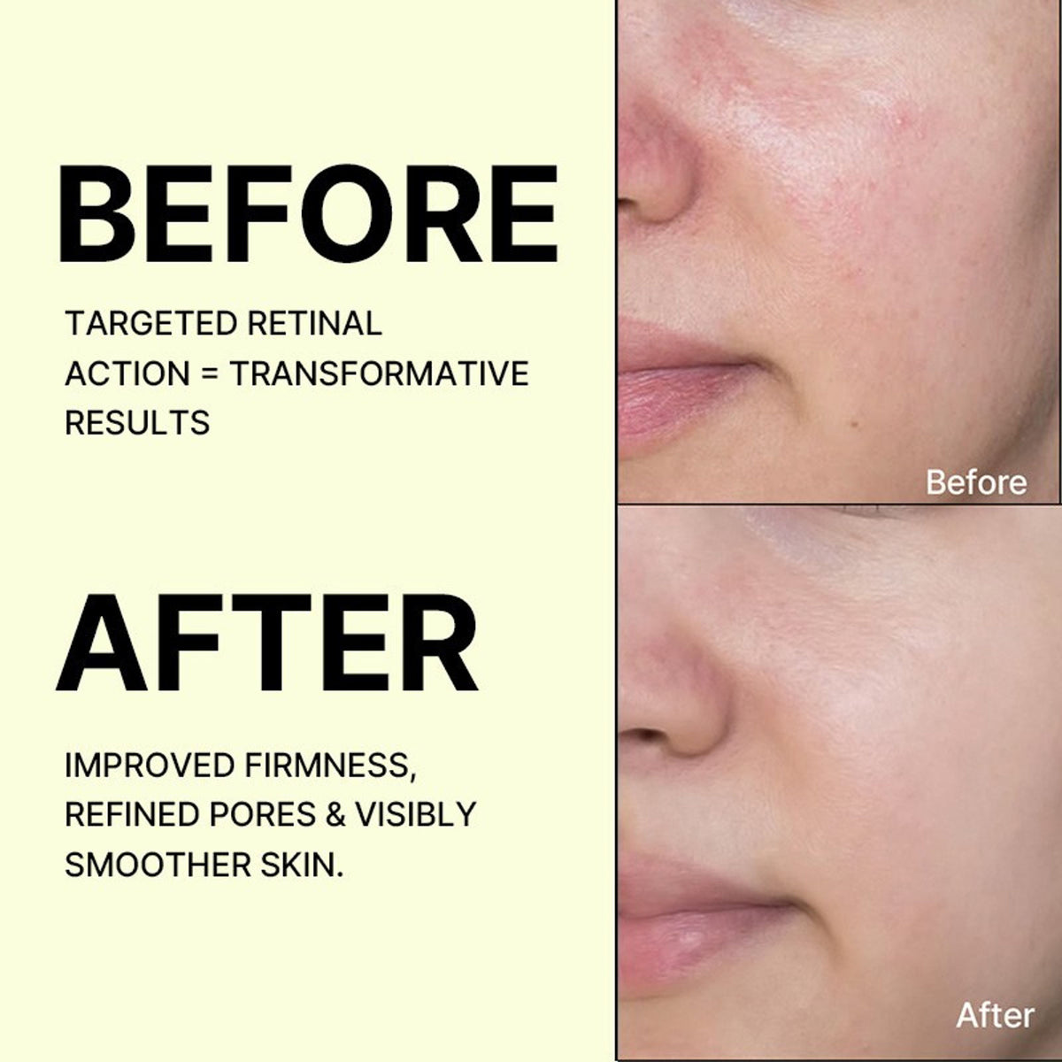Celimax The Vita-A Retinal Shot booster bottle, anti-aging skincare for dark spots and wrinkles, with a sleek design and dropper applicator.
