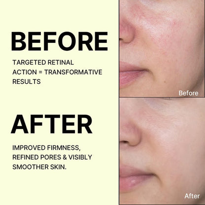 Celimax The Vita-A Retinal Shot booster bottle, anti-aging skincare for dark spots and wrinkles, with a sleek design and dropper applicator.