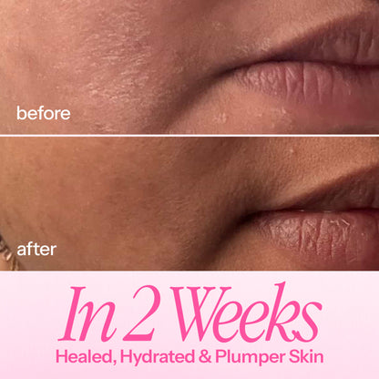 d'you In My Defence Barrier-Building Moisturiser With 20x More Ceramides (Lightweight & Non-Greasy)