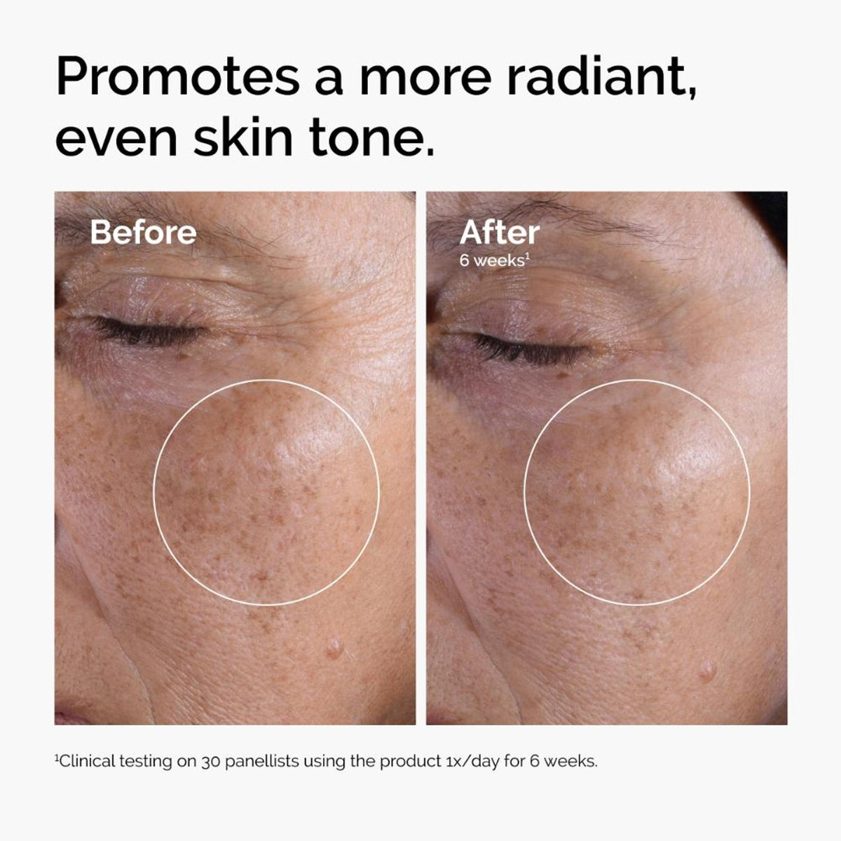 The Ordinary Glycolic Acid 7% Exfoliating Solution