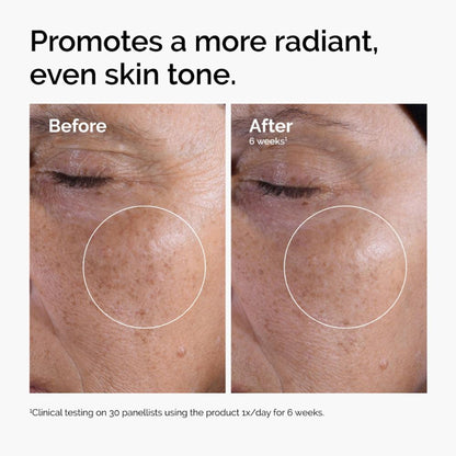 The Ordinary Glycolic Acid 7% Exfoliating Solution