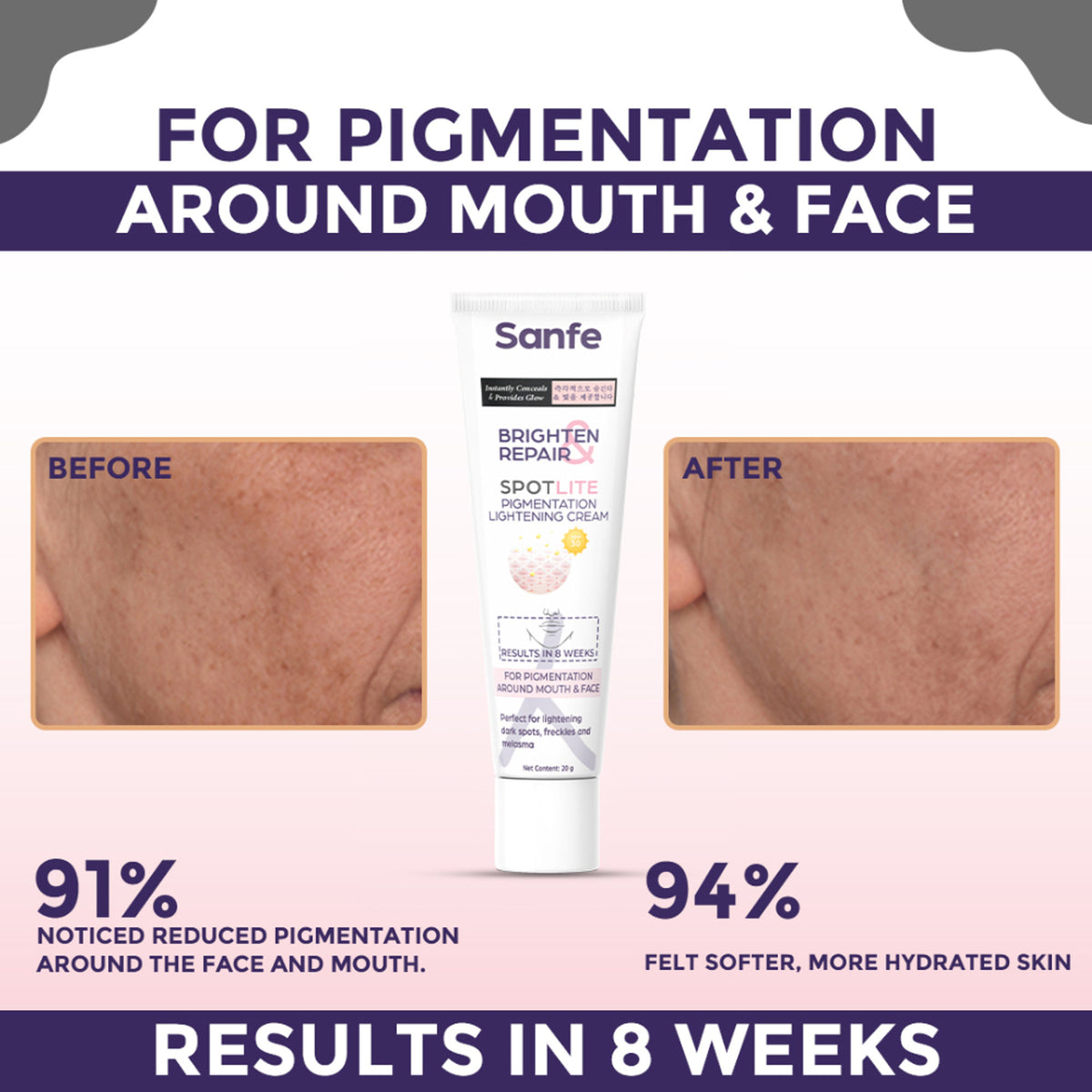 Sanfe Pigmentation Lightening Cream, Kojic Acid, Glutathione, Dark Spots Removal