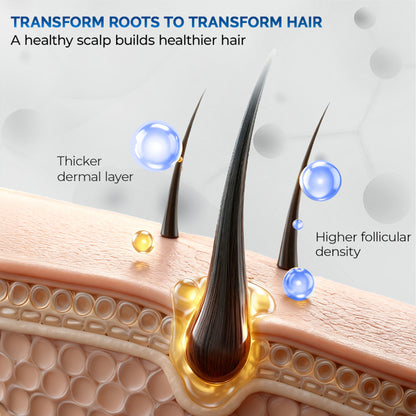 Streax Professional Anti Hairfall Shampoo with Rosemary for Hair Fall Control & Stronger Hair