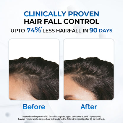 Streax Professional Anti Hairfall Shampoo with Rosemary for Hair Fall Control & Stronger Hair