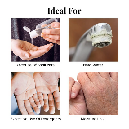 LuxaDerme Hand & Nail Rescue Cream with Shea Butter and Niacinamide, showing a tube of nourishing hand cream.