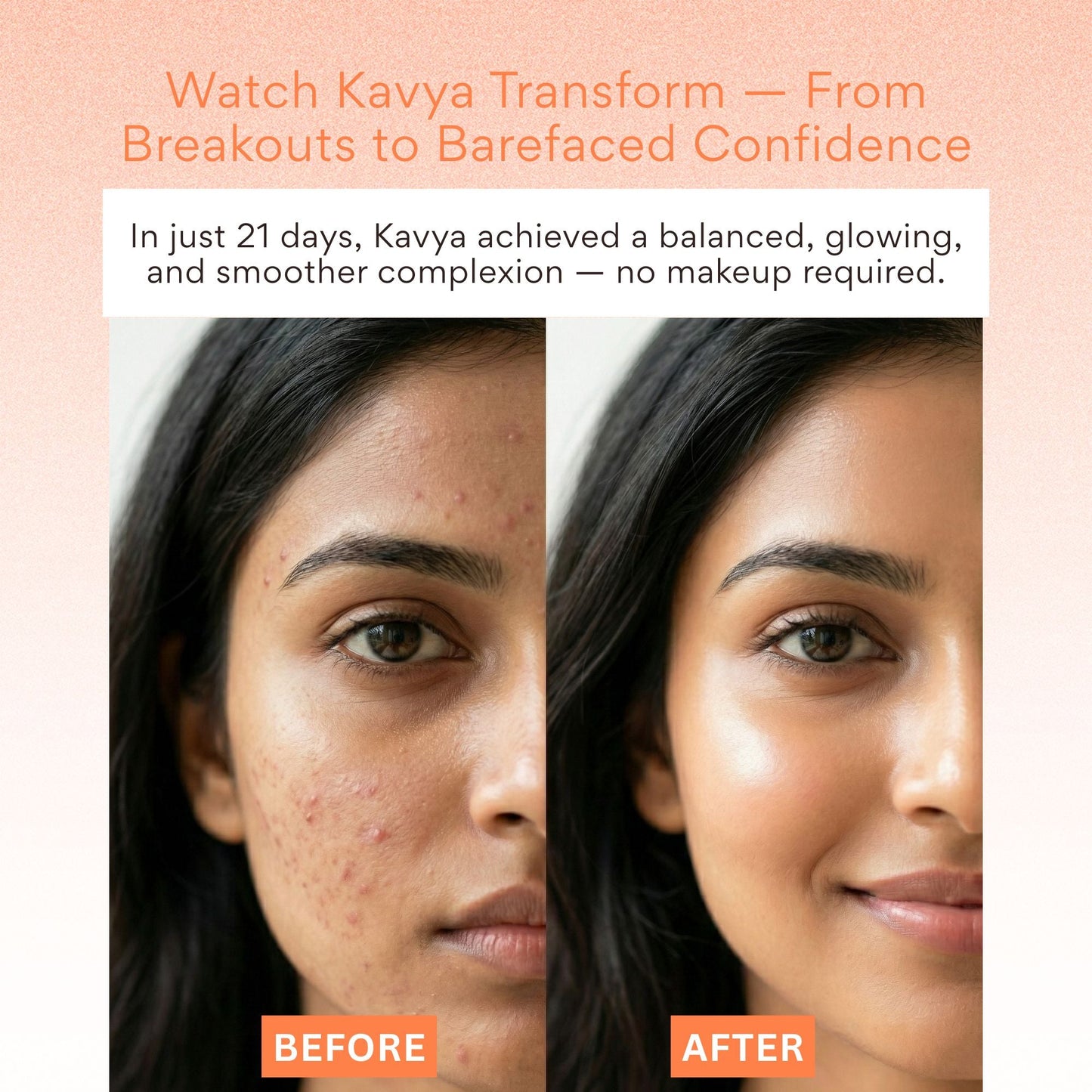 EOB 20% Vitamin C Serum with Hyaluronic Acid Face Serum
