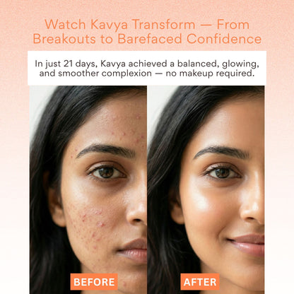 EOB 20% Vitamin C Serum with Hyaluronic Acid Face Serum