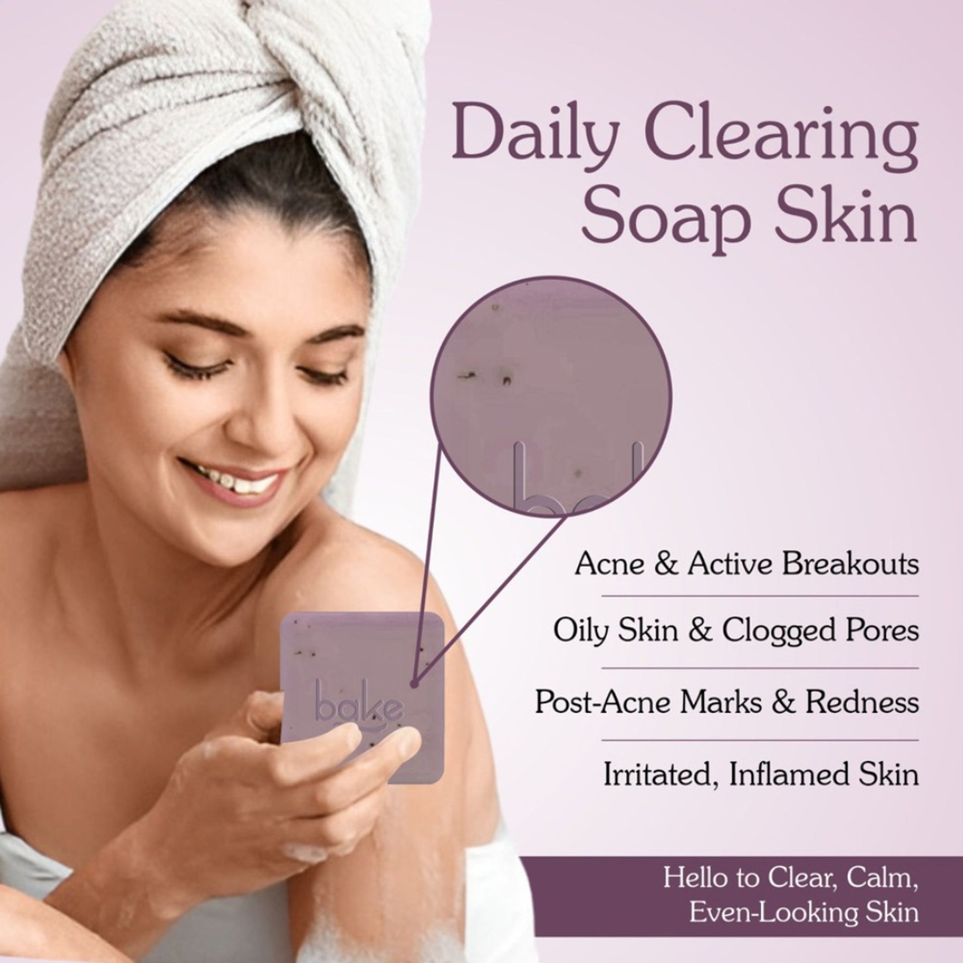 BAKE 10% Niacinamide + Azelaic Acid Soap for Body & Back Acne, Bright & Spot-Free Skin -Pack of 2