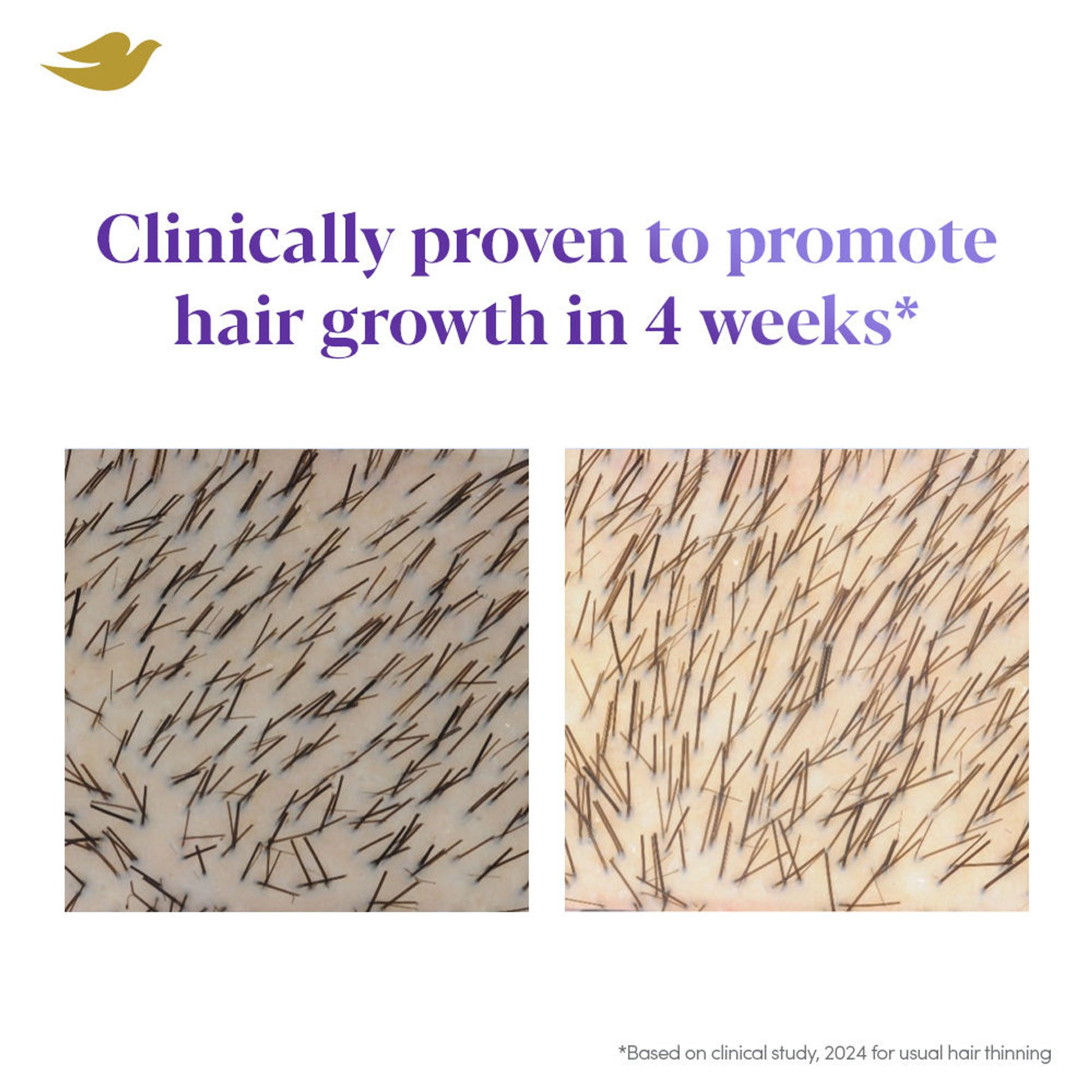 Dove Scalp + Hair Therapy Density Boost Revitalizing Scalp Night Serum