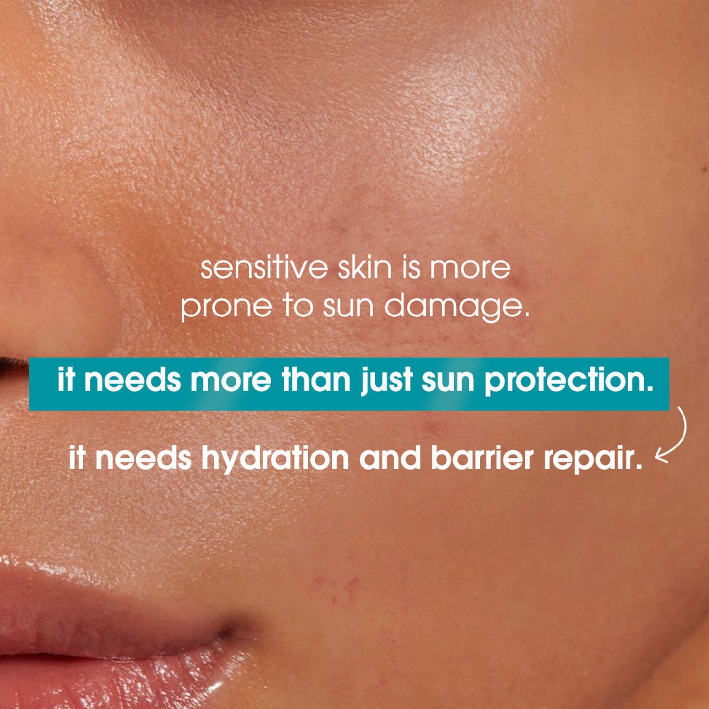 Simple Hydrating UV Fluid SPF 50 PA++++ Hyaluronic Acid Sunscreen For Dry & Sensitive Skin