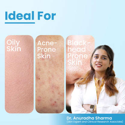 Fixderma Alpha Beta Acne Cleanser reducing pimples and excess sebum, deep pore cleansing, non-comedogenic skincare product.