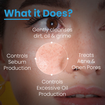 Fixderma Alpha Beta Acne Cleanser reducing pimples, controlling sebum, deep pore cleansing, non-comedogenic skincare product image
