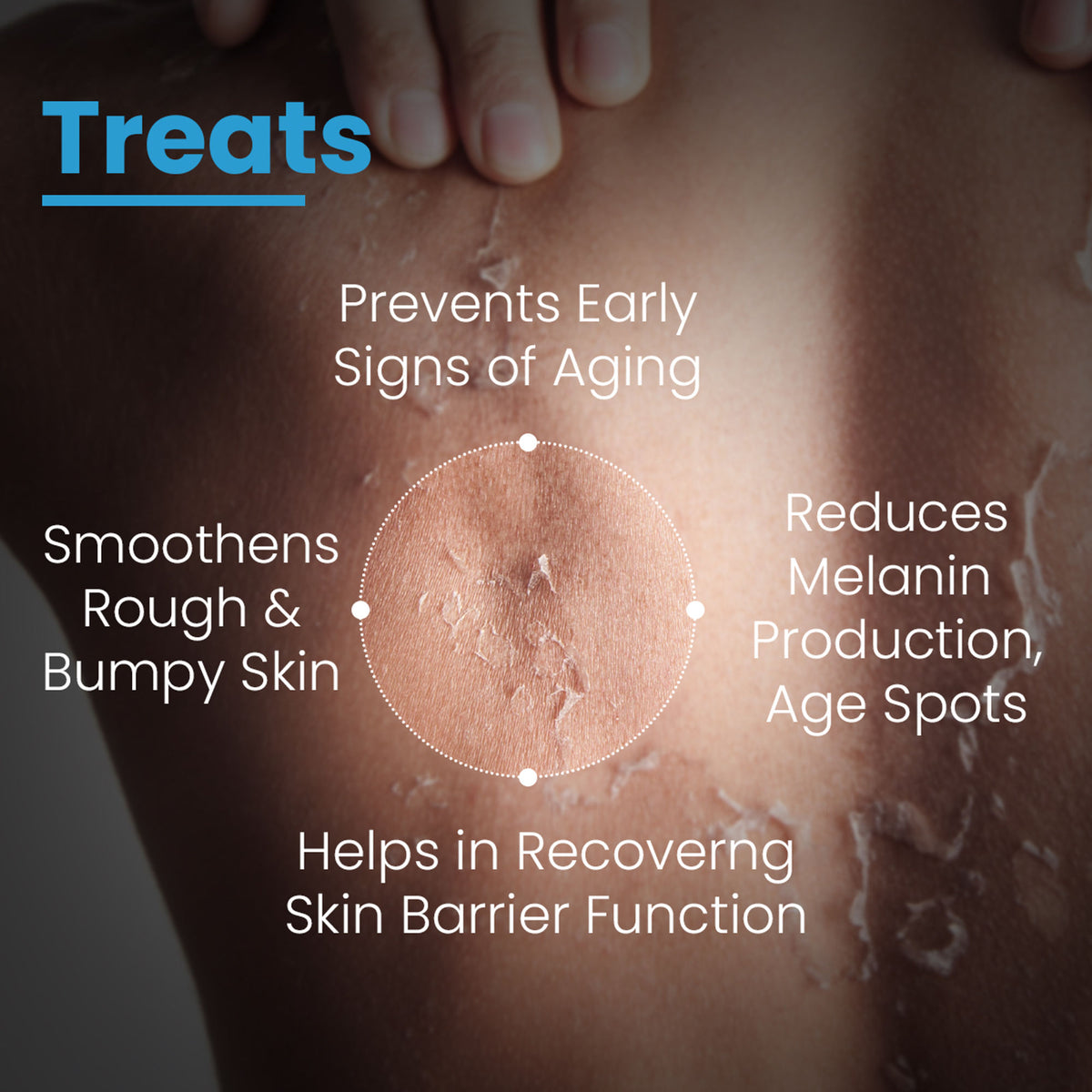 FCL Bio Retinol Body Lotion, For SkinAgeing, Keratosis Pilaris, Smoothen, Bumpy & Tanned Skin
