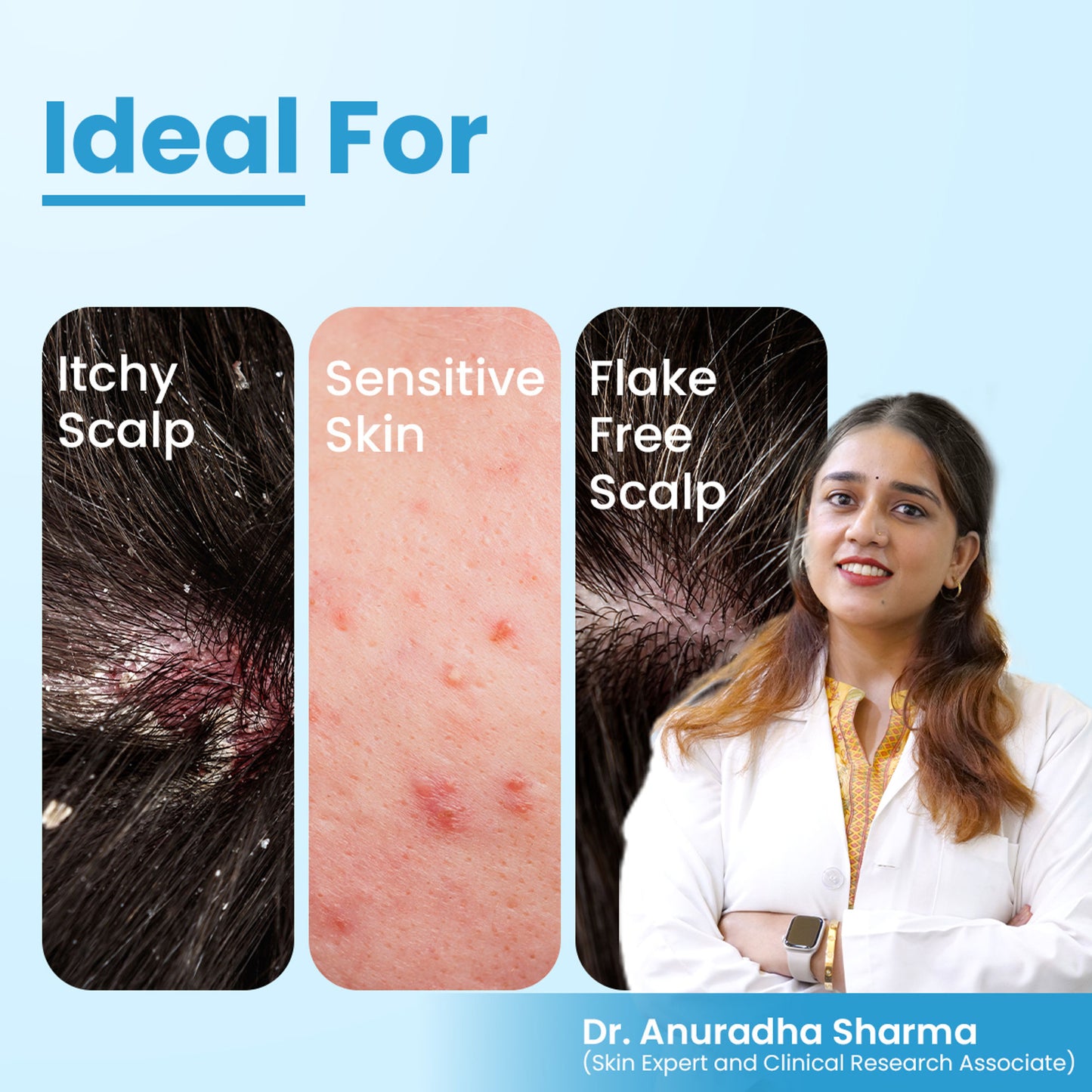 FCL TShampoo For Dandruff, Scalp Psoriasis, Nourishes Scalp, Sulphate & Paraben Free