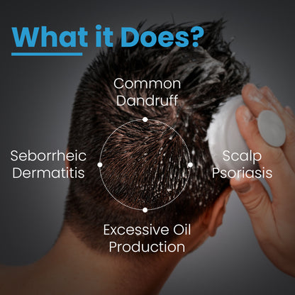 FCL TShampoo For Dandruff, Scalp Psoriasis, Nourishes Scalp, Sulphate & Paraben Free