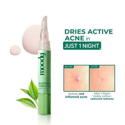 Moody Acnexpert Overnight Spot Corrector Pen With Salicylic Acid, Sulfur & Zinc For Active Acne
