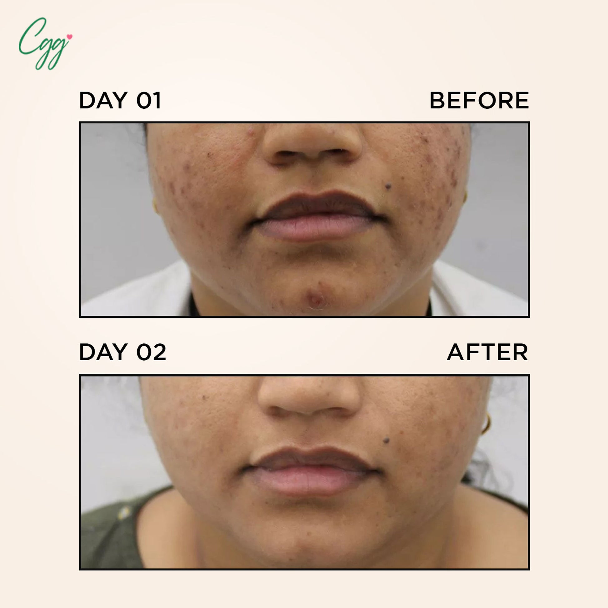 CGG Cosmetics 70% Snail Mucin Essence + FREE All In One Cream
