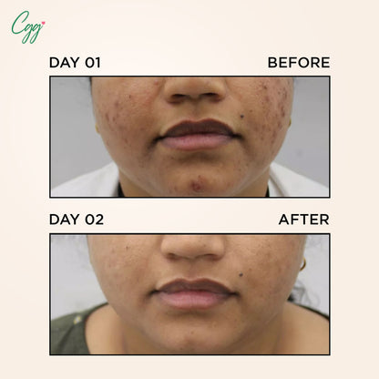 CGG Cosmetics 70% Snail Mucin Essence + FREE All In One Cream