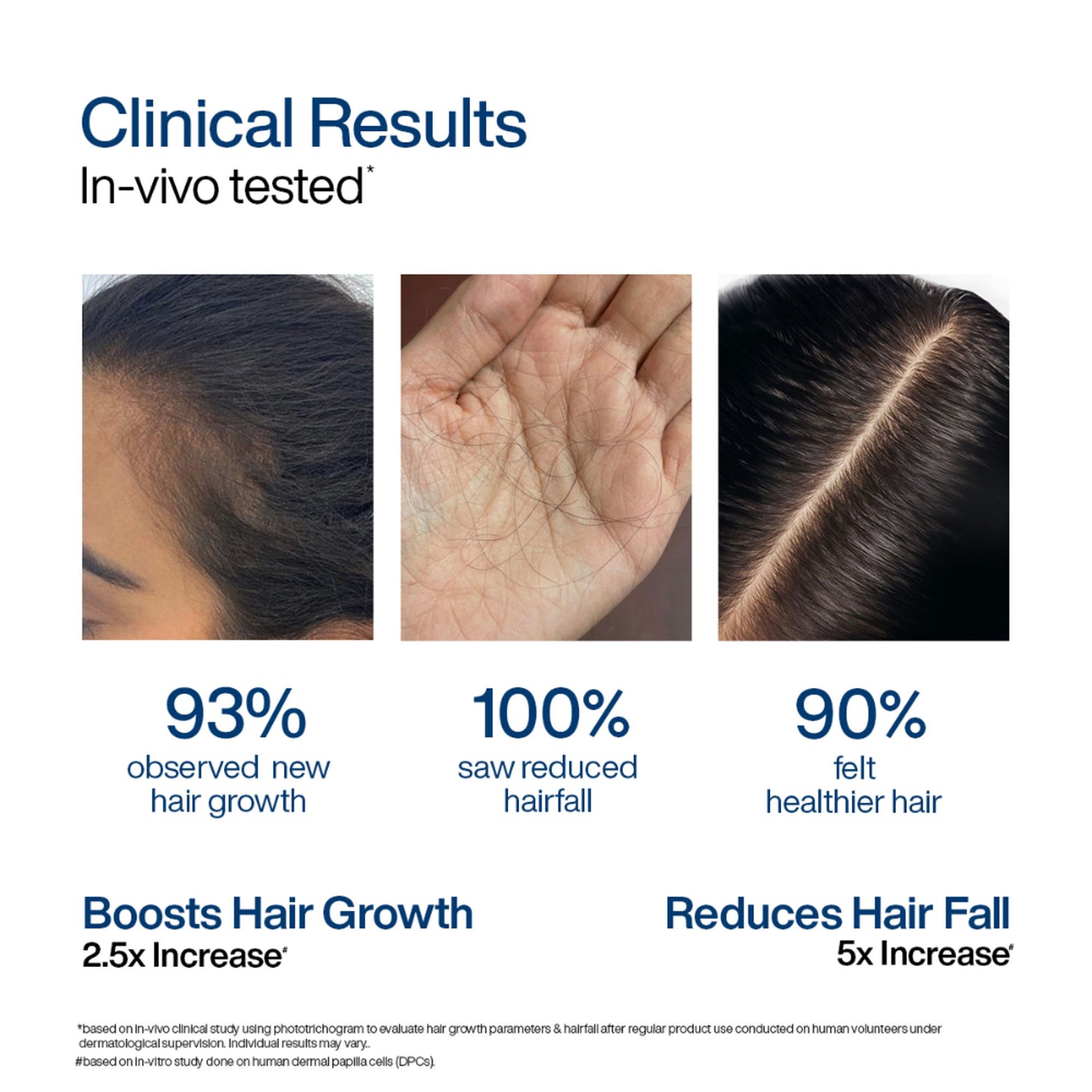 Wishcare Hair Growth Serum Concentrate,In-Vivo Tested,Redensyl, Anagain, Biotin,Keratin & Rice Water
