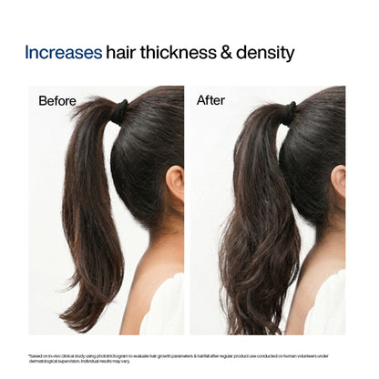 Wishcare Hair Growth Serum Concentrate,In-Vivo Tested,Redensyl, Anagain, Biotin,Keratin & Rice Water