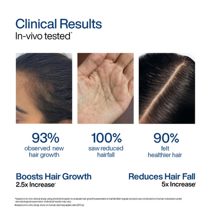 Wishcare Hair Growth Serum Concentrate,In-Vivo Tested,Redensyl, Anagain, Biotin,Keratin & Rice Water