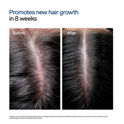 Wishcare Hair Growth Serum Concentrate,In-Vivo Tested,Redensyl, Anagain, Biotin,Keratin & Rice Water