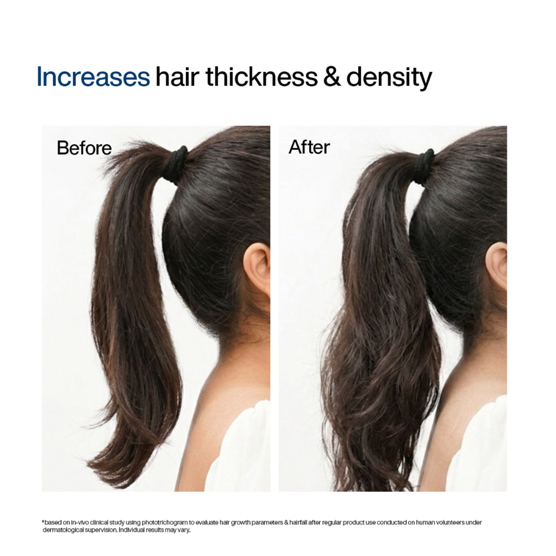 Wishcare Hair Growth Serum Concentrate,In-Vivo Tested,Redensyl, Anagain, Biotin,Keratin & Rice Water