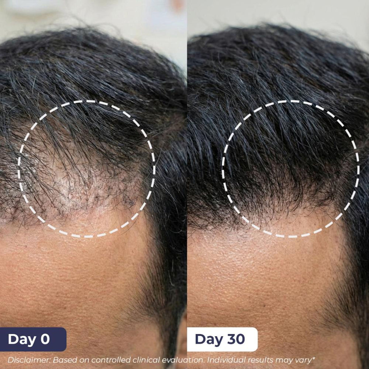 Conscious Chemist Full Strength Anti-Hairfall Shampoo