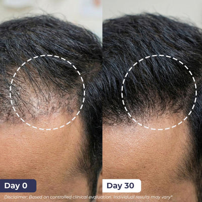 Conscious Chemist Full Strength Anti-Hairfall Shampoo