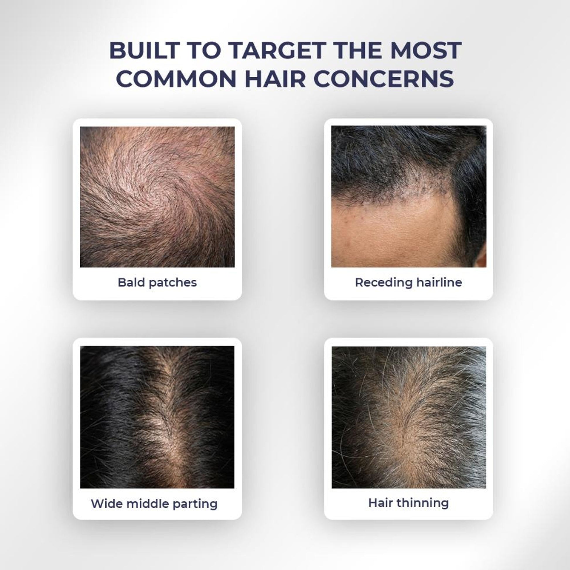 Conscious Chemist Full Strength Anti-Hairfall Post Wash Rosmeary Spray