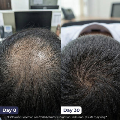 Conscious Chemist Full Strength Hair Growth Serum