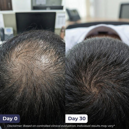 Conscious Chemist Full Strength Hair Growth Serum