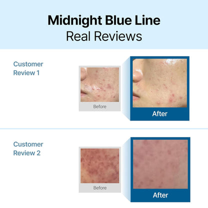 Klairs Midnight Blue Calming Cream