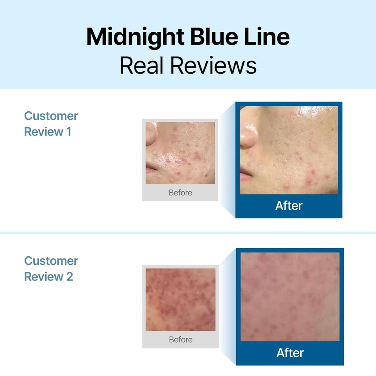 Klairs Midnight Blue Calming Cream