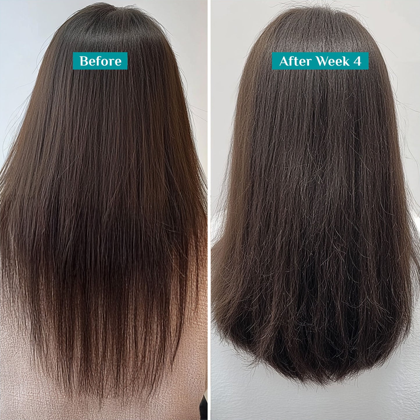 Pilgrim Redensyl & Anagain Hairfall Control Shampoo With Growth Boosters For Thick & Dense Hair
