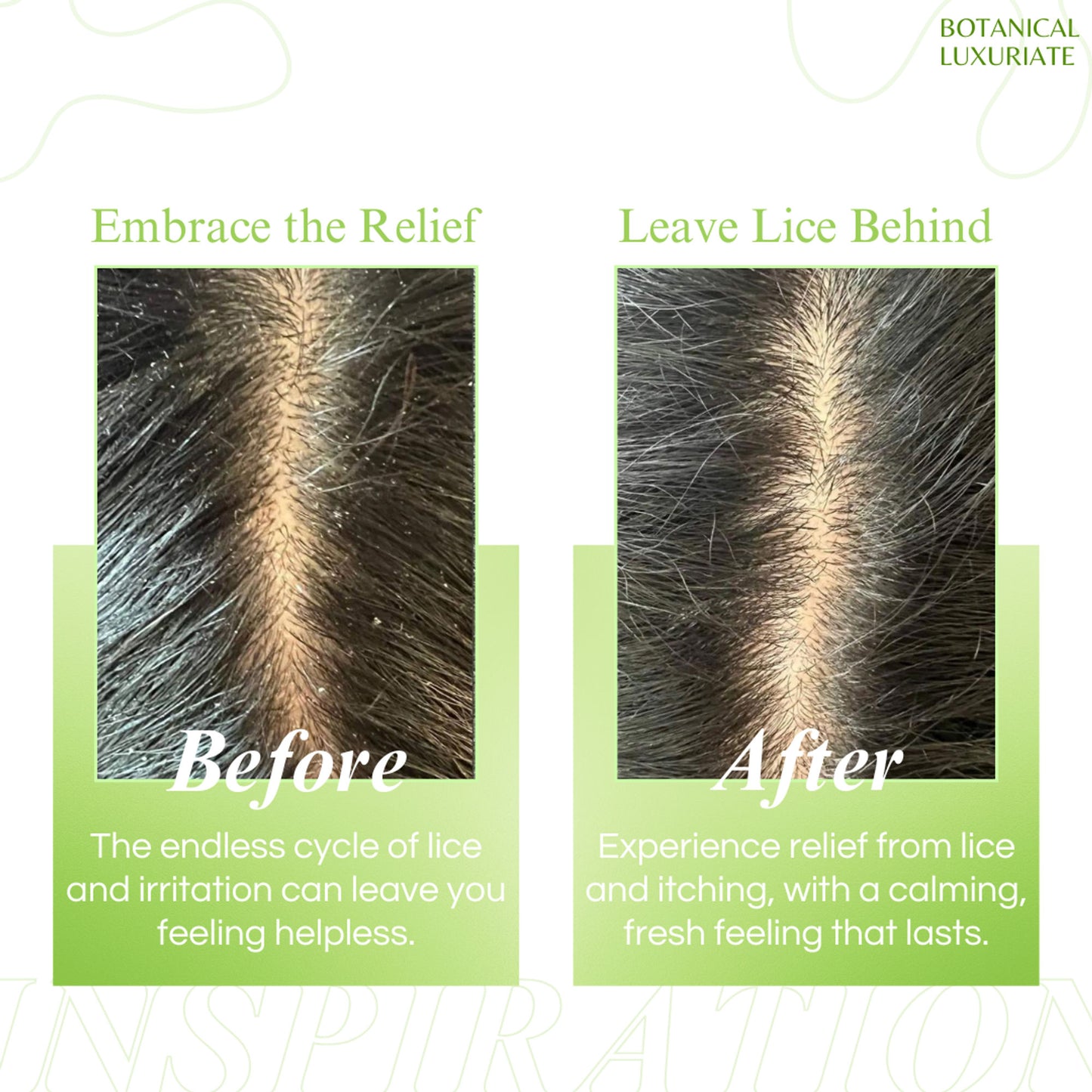Botanical Luxuriate Tea Tree Shampoo For Lice & Nits