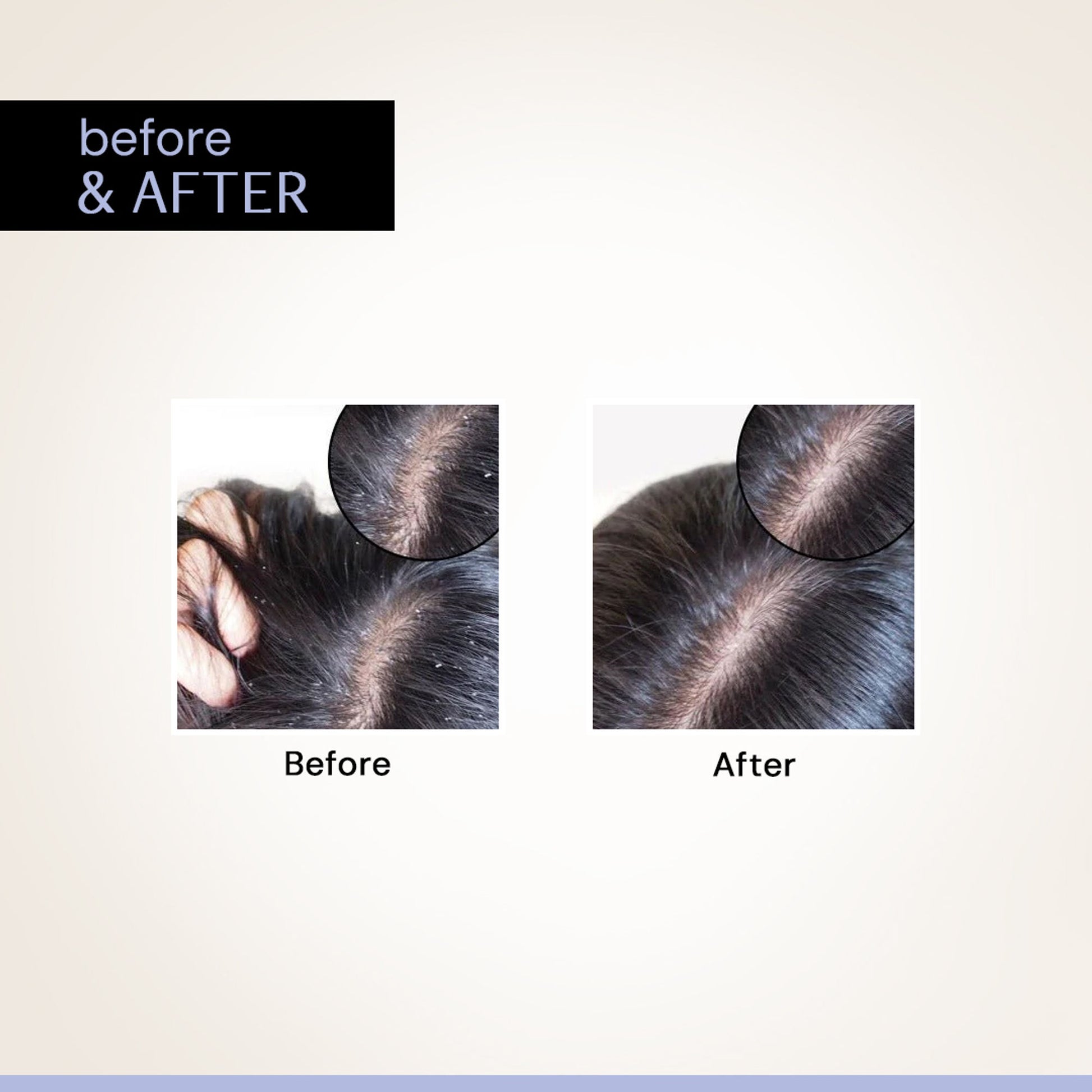 Deconstruct Anti Dandruff Serum, Exfoliates & Soothes Scalp
